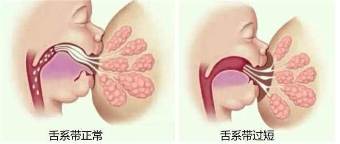 下载3.png