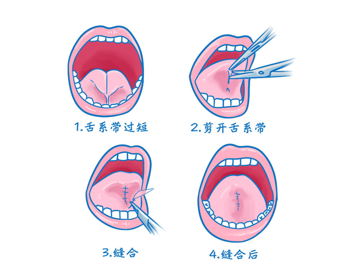 5.png